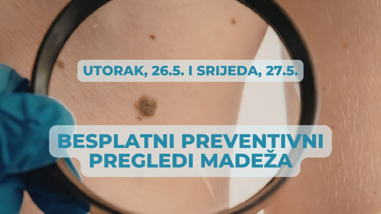 Besplatni pregledi madeža u utorak i srijedu u Umagu