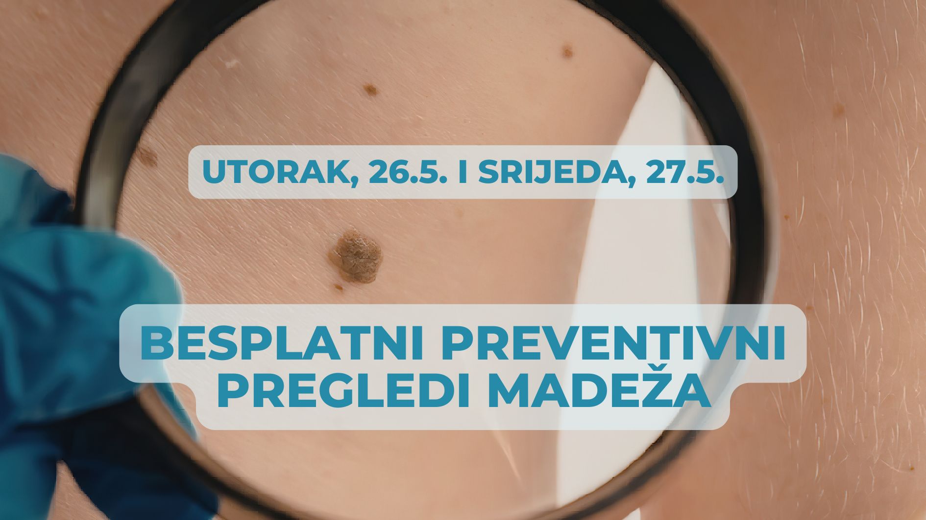Besplatni pregledi madeža u utorak i srijedu u Umagu